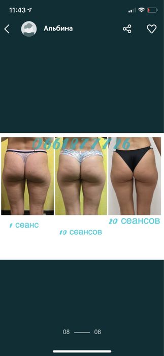 Антицеллюлитный массаж , ручной массаж