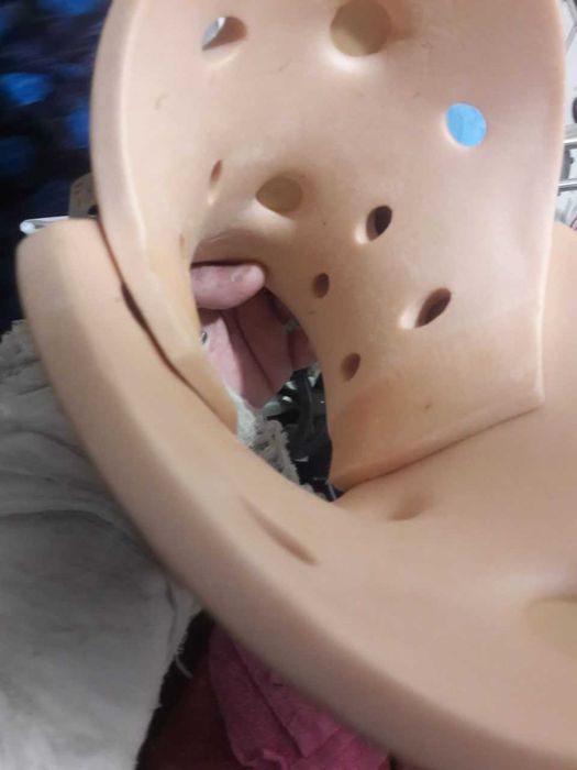 БАНДАЖ ДЛЯ ШЕИ\Для позвоночника\ Воротник (шейный ретрактобез отправок