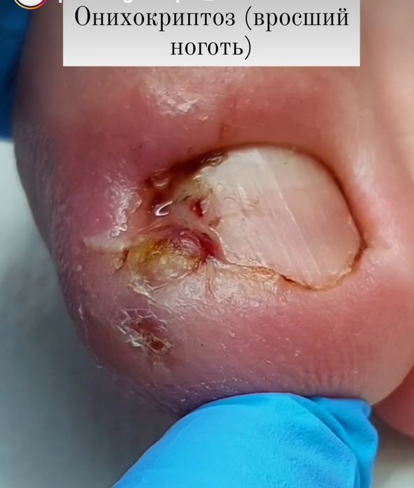 Подолог .Врач.Предлагаю услуги женского и мужского педикюра и маникюра