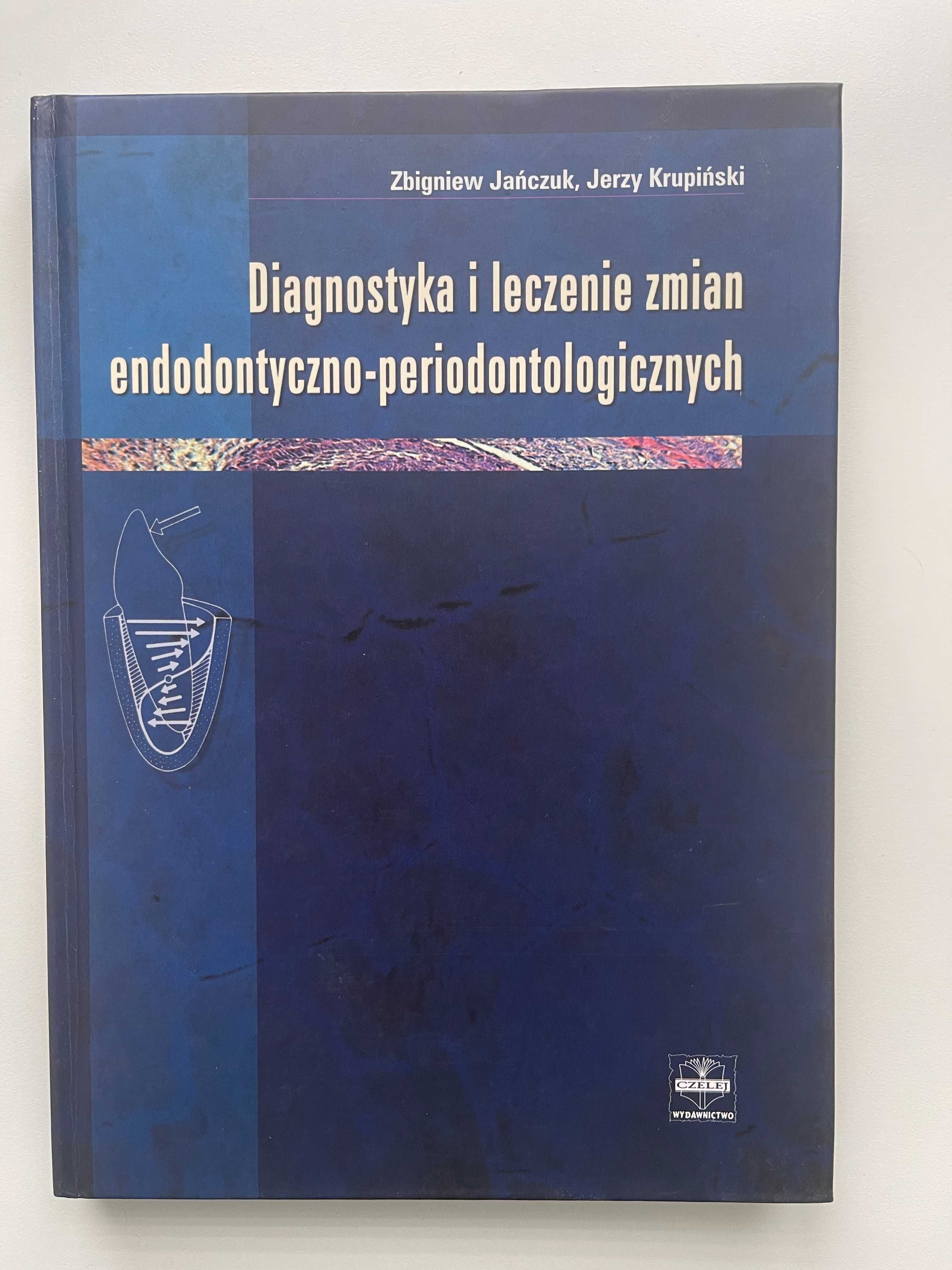 Diagnostyka i leczenie zmian endodontyczno-periodontologicznych