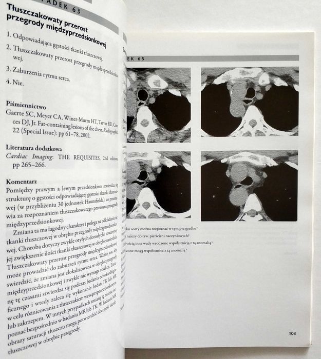 Diagnostyka obrazowa SERCE. Przypadki kliniczne, Reddy, Steiner, NOWA!