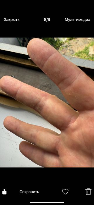 Дерматолог. Консультация онлайн