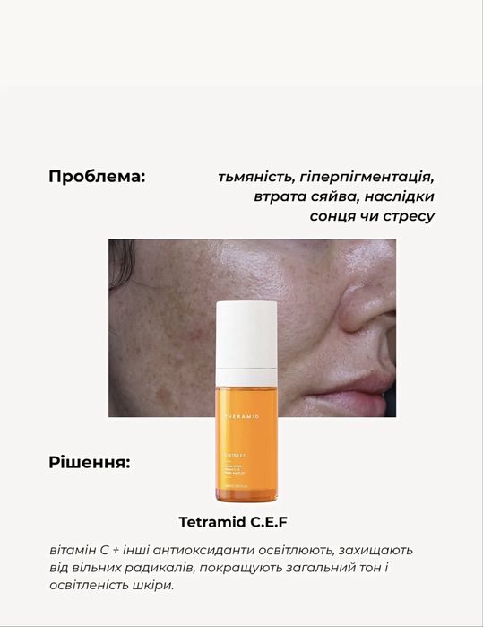 Сороватка Theramid