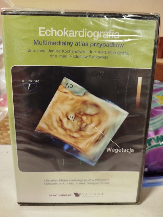 Echokardiografia Multimedialny atlas przypadków folia