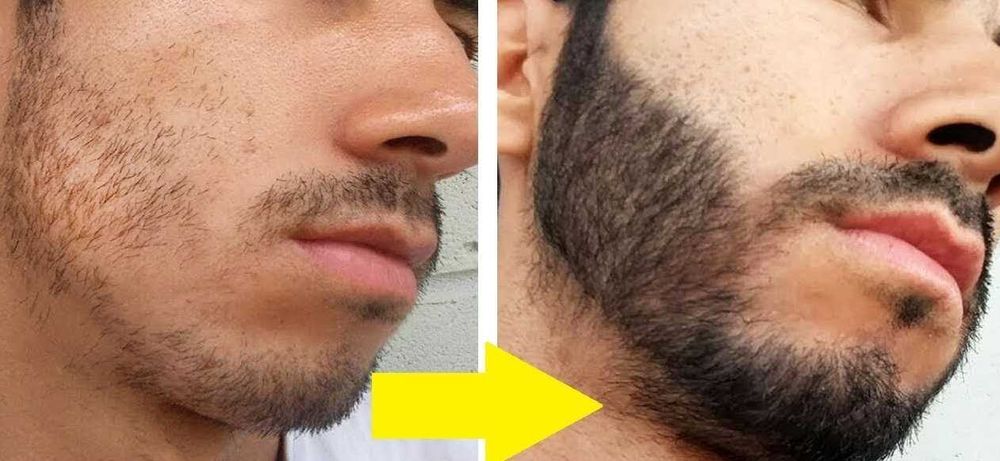 Інтенсивний ГЕЛЬ для стимуляції росту , відновлення , зміцнення БОРОДИ