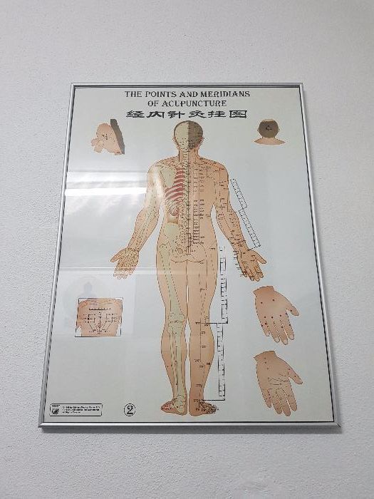 3 Pôster's de Acupuntura /Meridianos