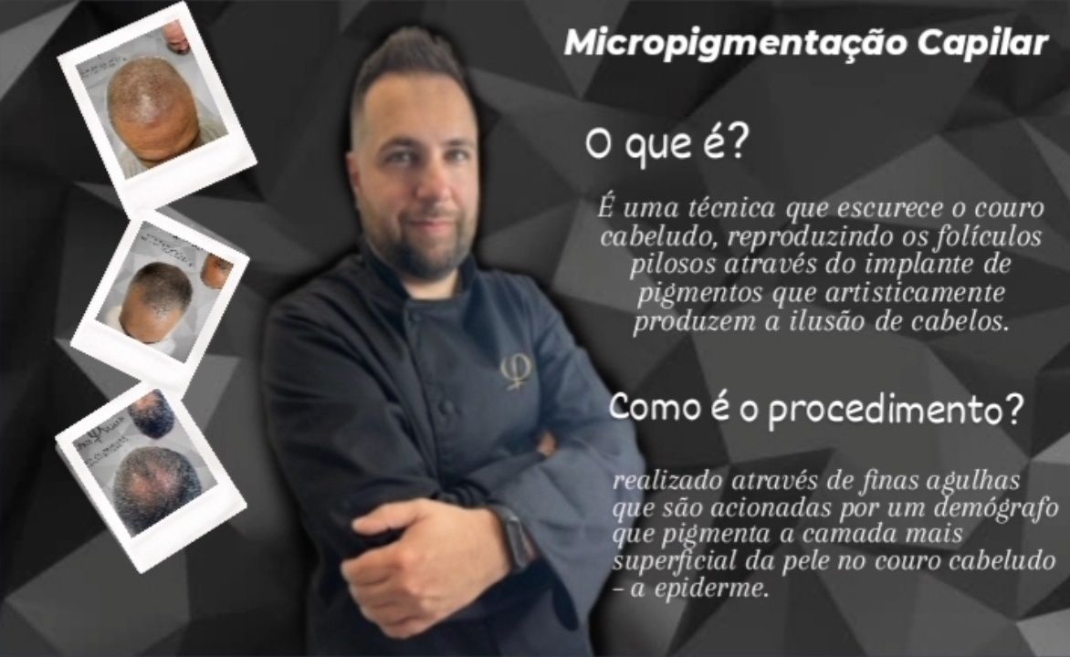 Micropigmentação Capilar