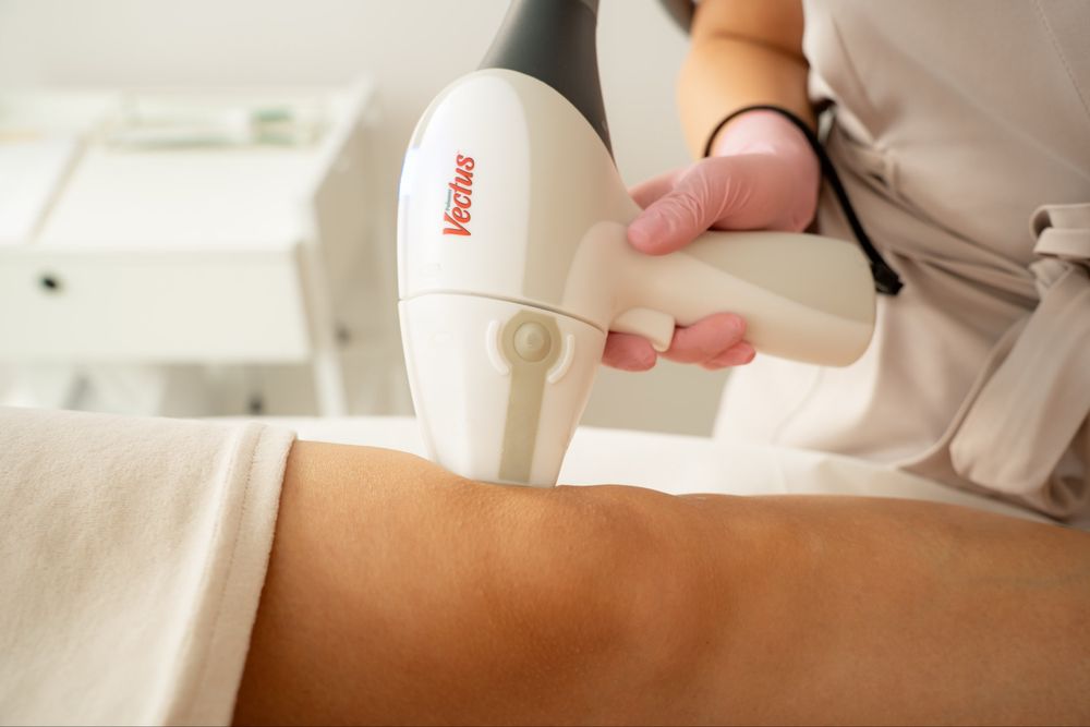 Wynajem laser do depilacji Vectus