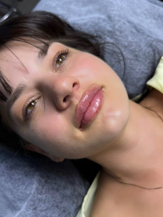 Потрібні моделі на збільшення губ