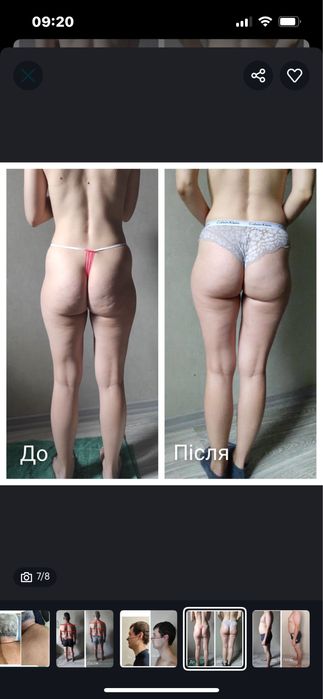 Масажист реабілітолог