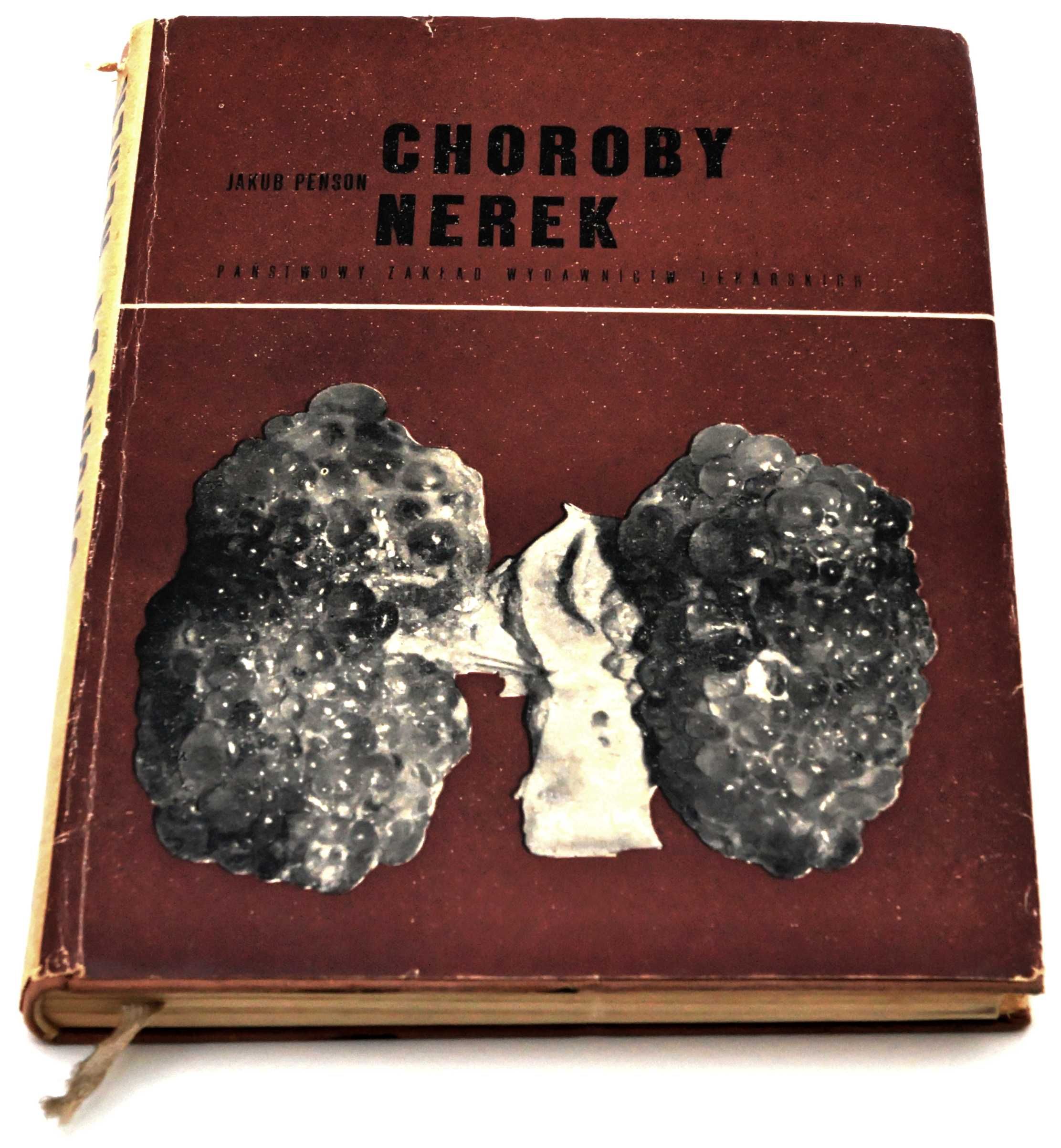 Choroby nerek Jakub Penson