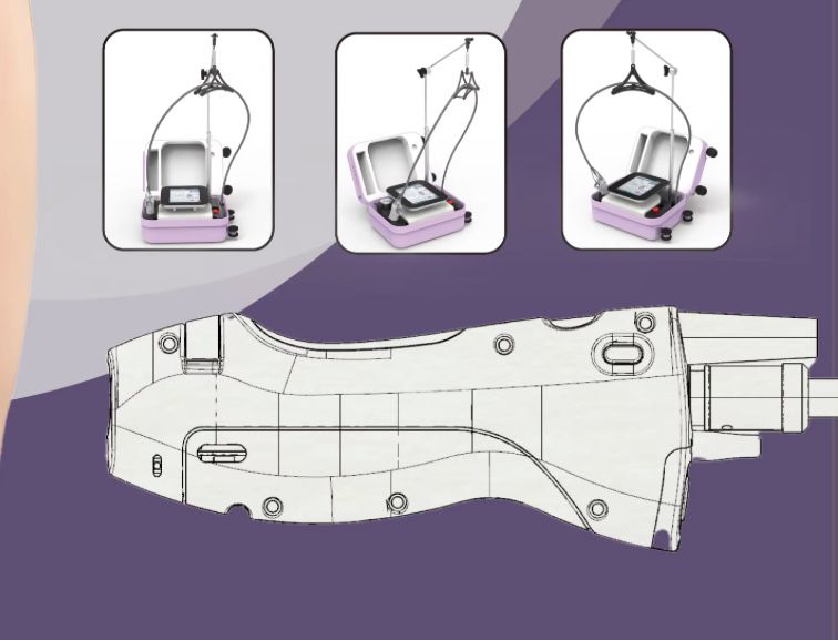 Maquina depilacao laser yag