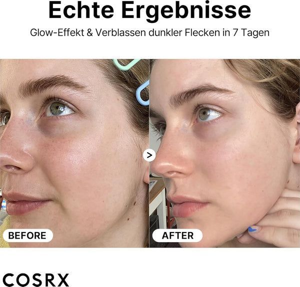 Soro puro de vitamina C com vitamina E (ácido ascór) ácido hialurónico