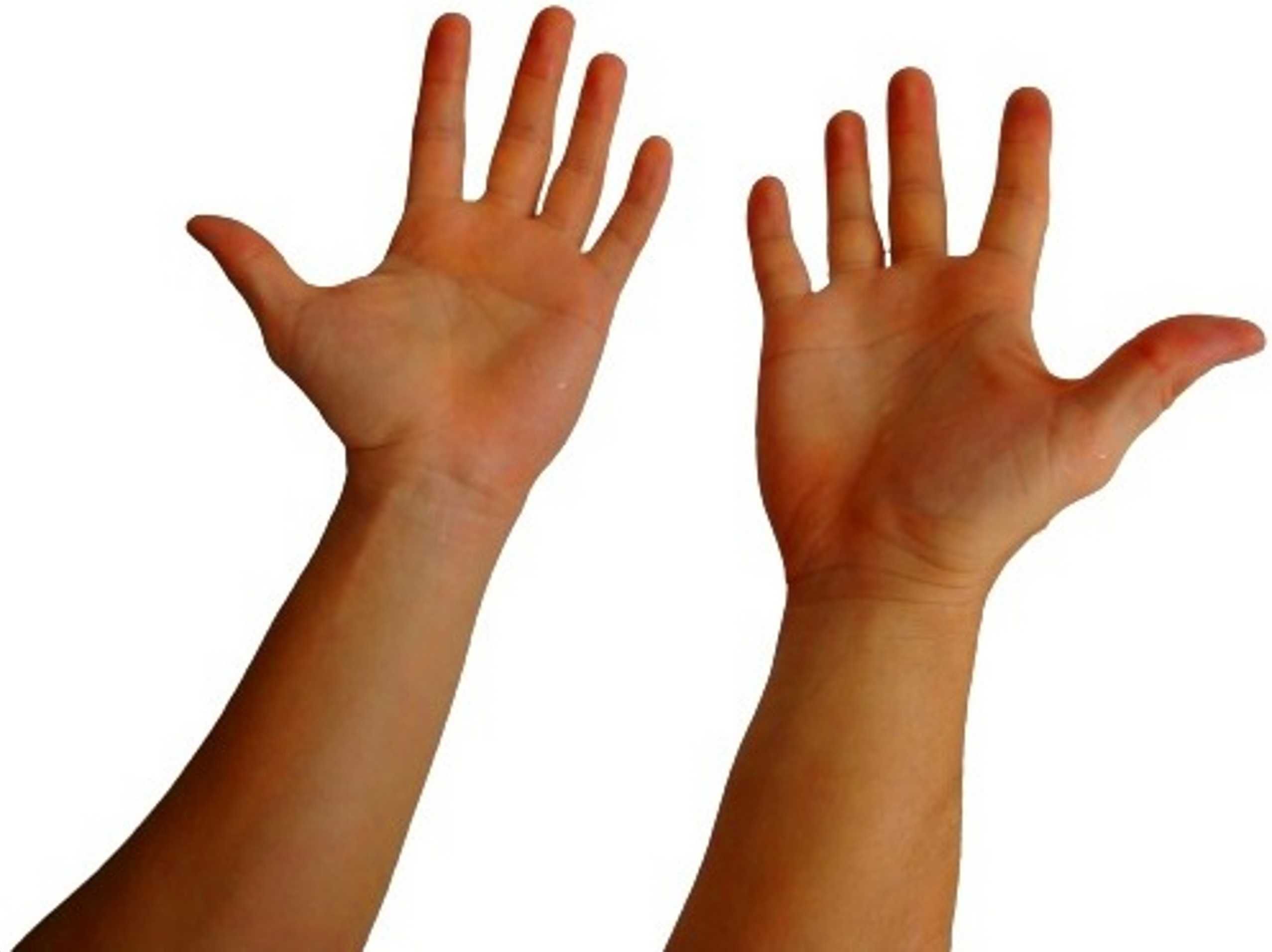 Urządzenie do jonoforezy NADPOTLIWOŚĆ Dłonie stopy ręce HIPERHYDROZA