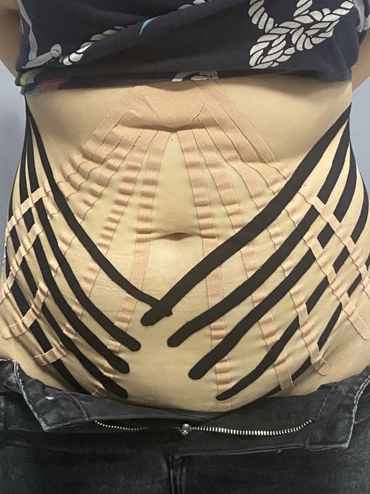 Лікувальний, оздоровчий, профілактичний масаж. Навчання. Чернівці.