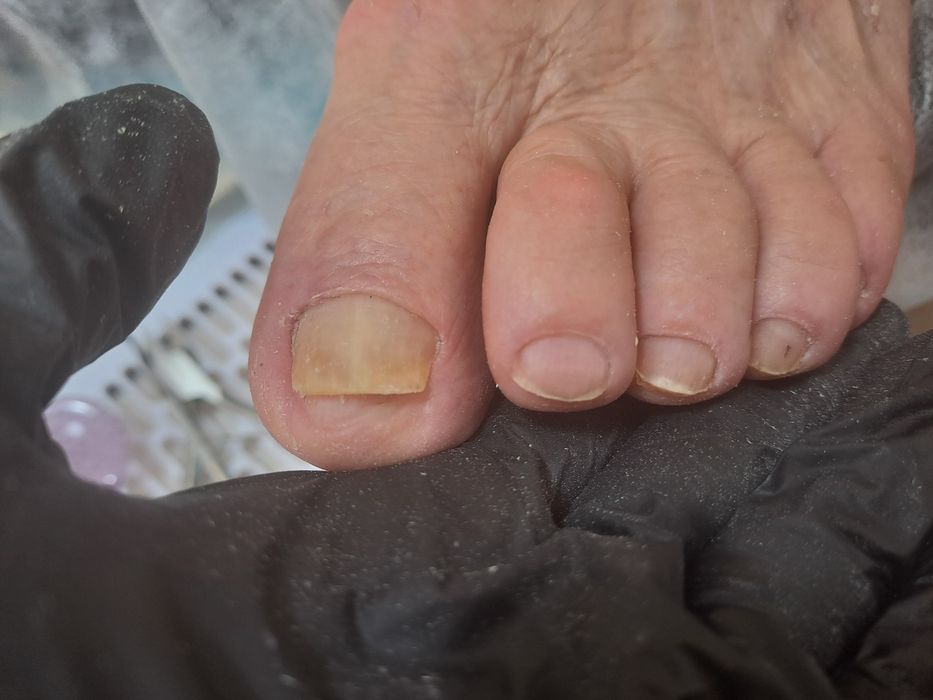 Апаратний педикюр з основами подології в місті СУМИ