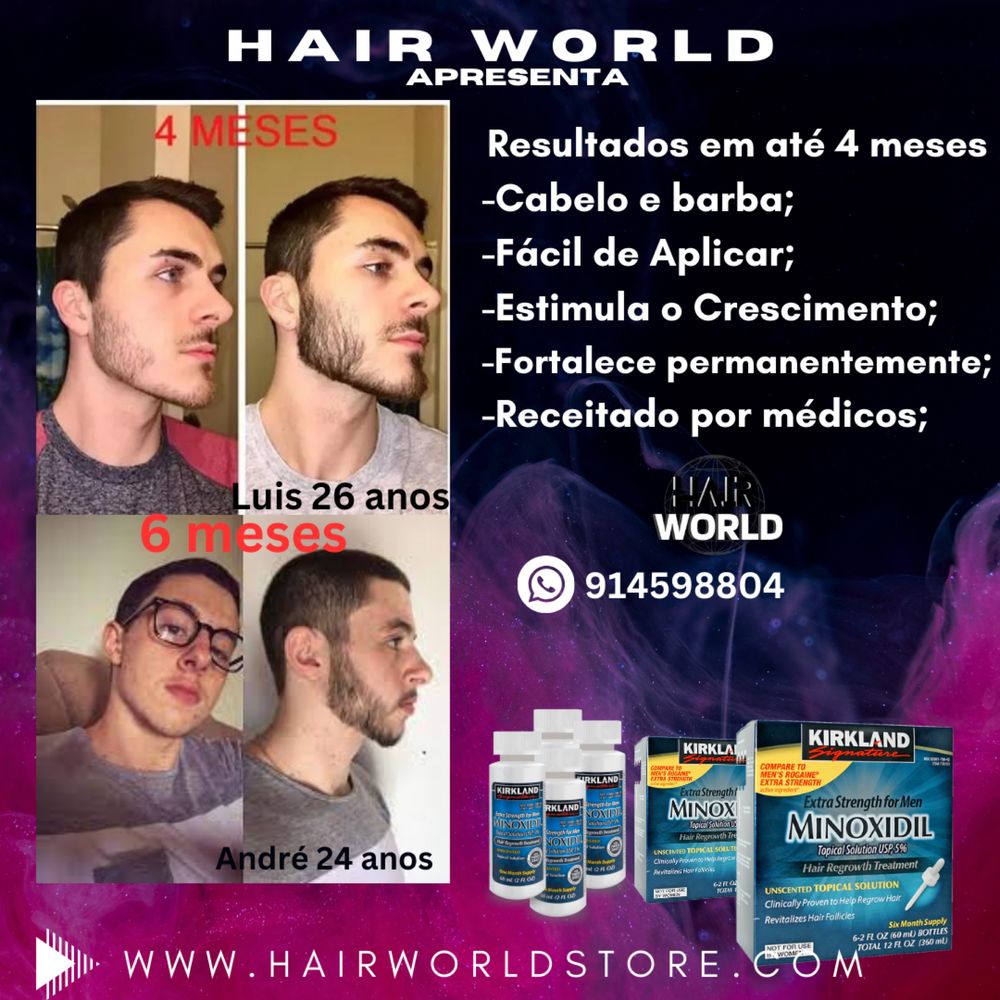 Minoxidil 5% Kirkland a venda em Portugal