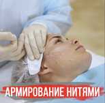 Тредлифтинг лица подтяжка нитями , армирование лица и тела.