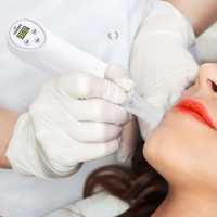 Diamond Peeling 17 Microdermoabrasão com Vácuo