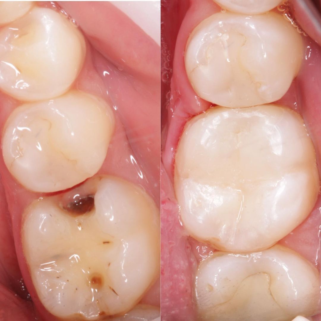 Врач-стоматолог  лечение чистка