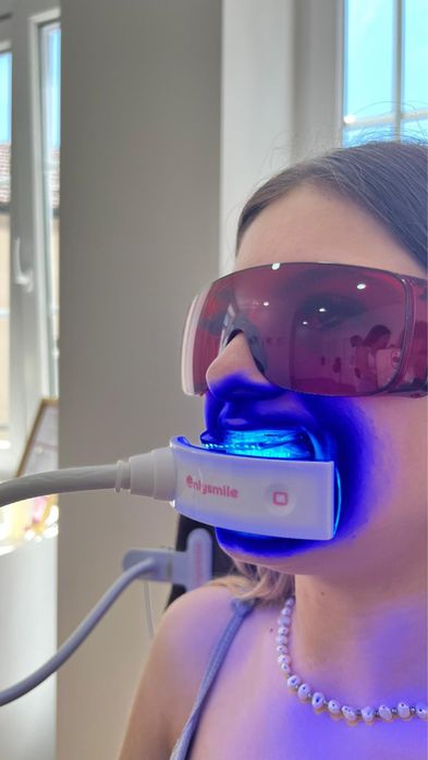 Maquina Branqueamento dentário - Estética