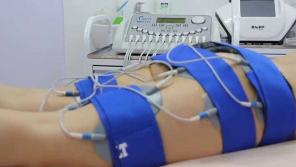 Антицеллюлитный массаж, обвертывание,  кавитация,  рфлифтинг, миостум