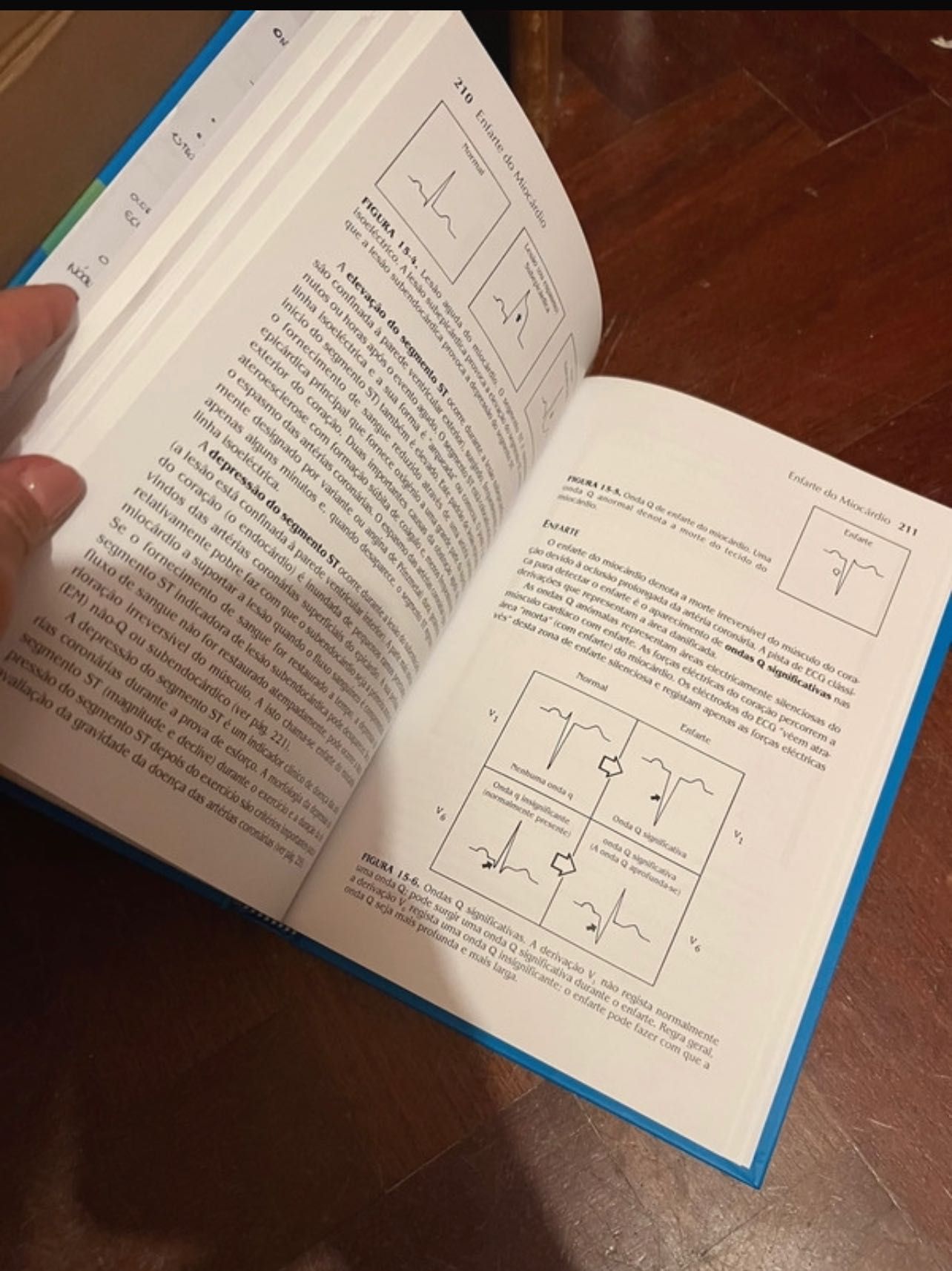 Livro ECG - avaliação e interpretação