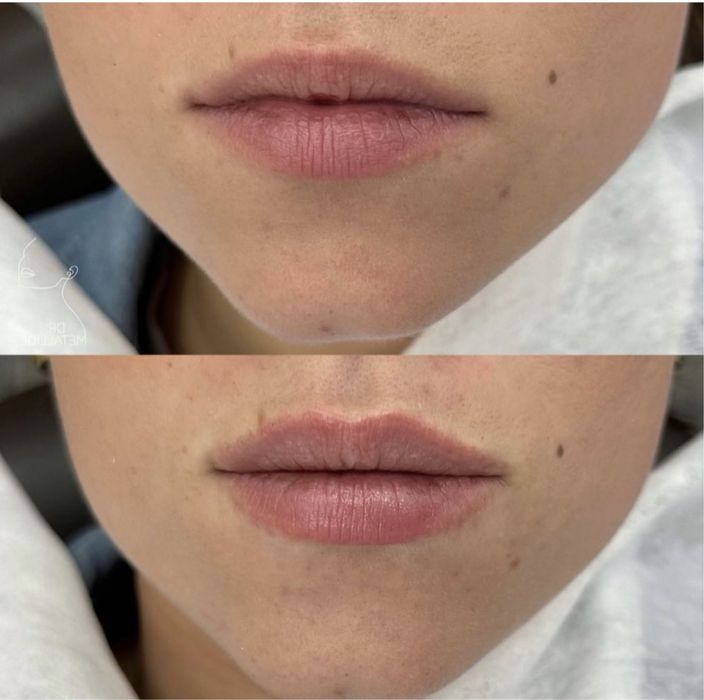 АКЦІЯ  Губи від 1500 грн, модель по собівартості, Київ, палац Україна