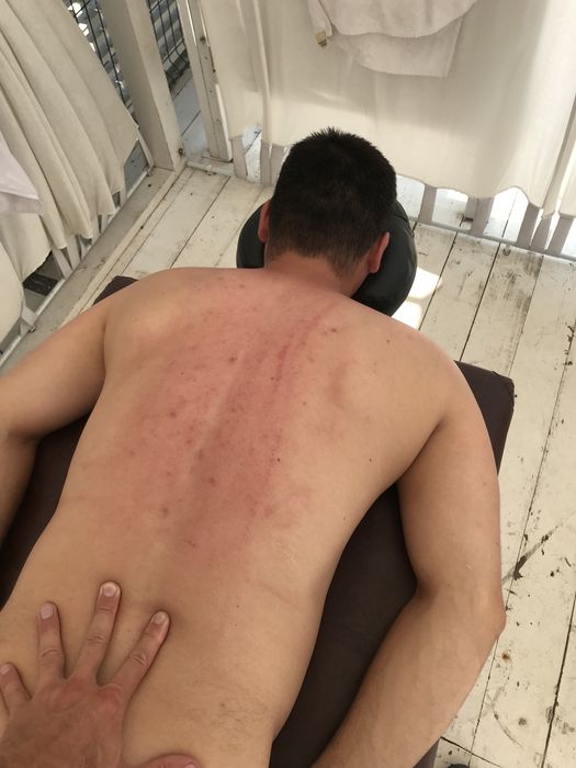 Лікувальний масаж