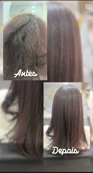 Botox selagem progressiva