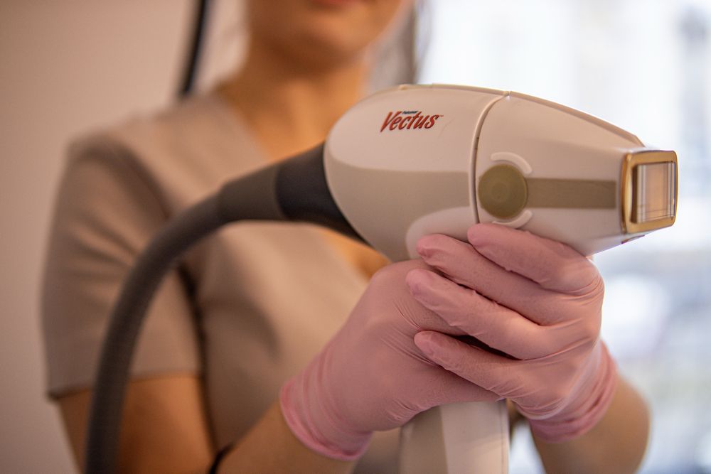 Wynajem laser do depilacji Vectus
