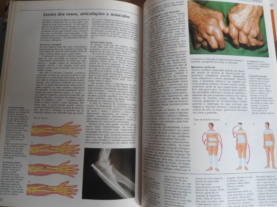 Enciclopédia do Conhecimento-Ciência e Tecnologia-1990