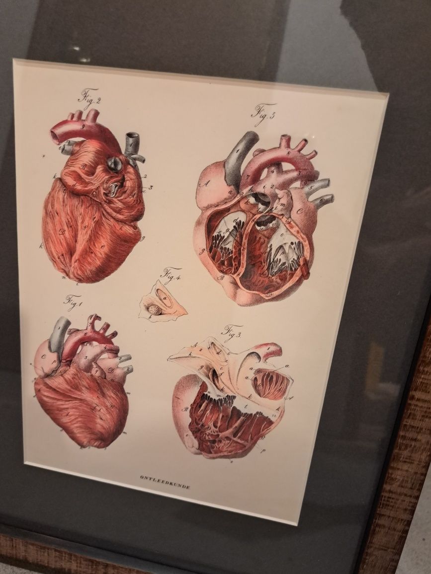 Serigrafia coração com moldura da mool