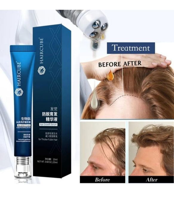 Корейський засіб для росту і проти випадіння волосся