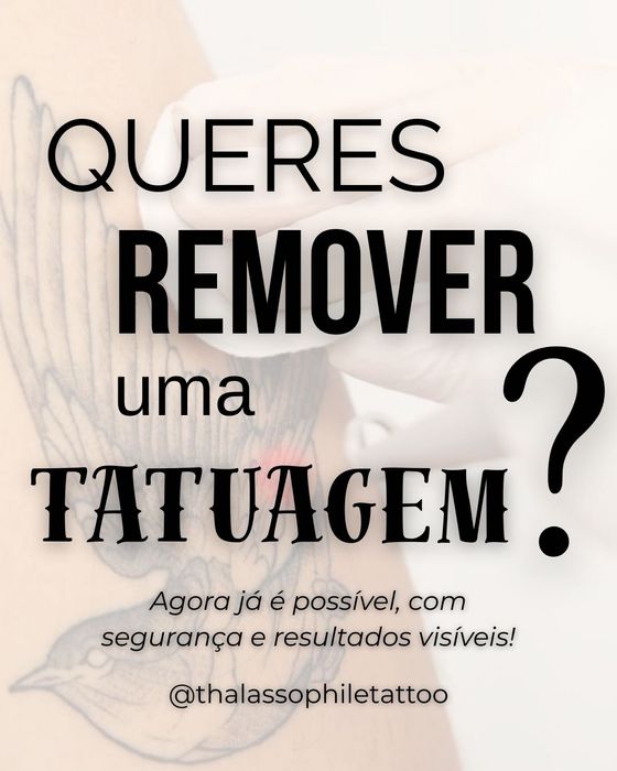 Remoção de Tatuagens a laser e Peeling de Hollywood