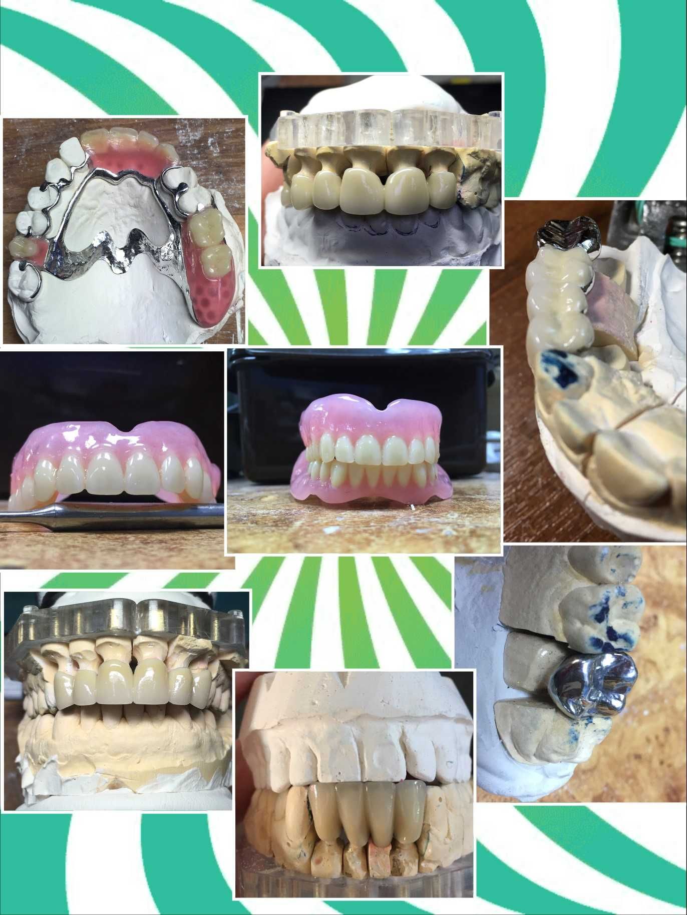 Зубной Техник ищу Стоматолога для сотрудничества