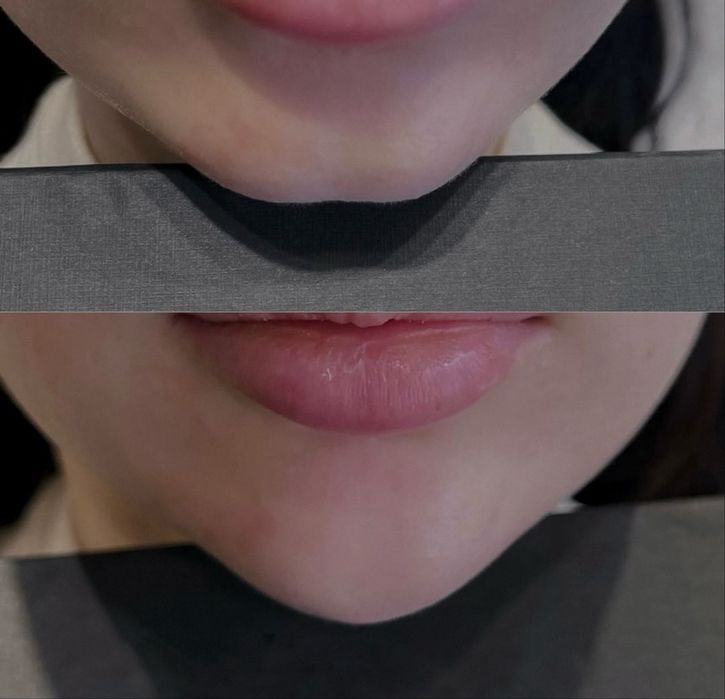 Моделі для збільшенення губ