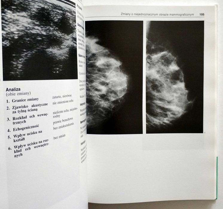 Atlas ultrasonograficzny sutka, Leucht, Madjar, UNIKAT!