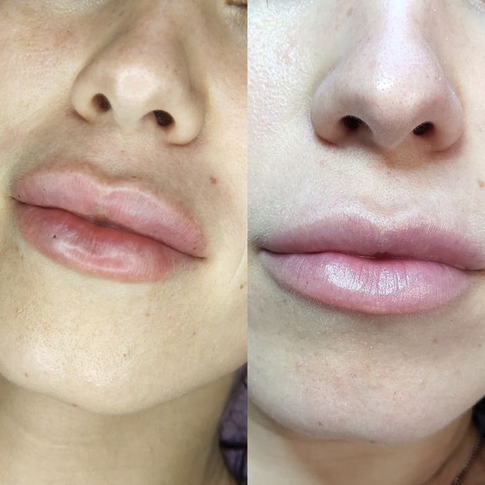 Косметолог Чистка лица Днепр Пр. Поля