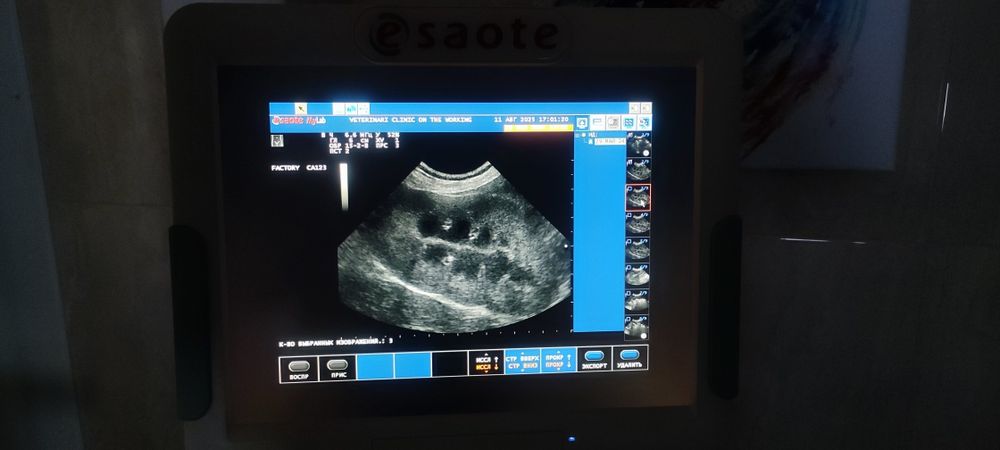 УЗД апарат. Esaote MyLab 40