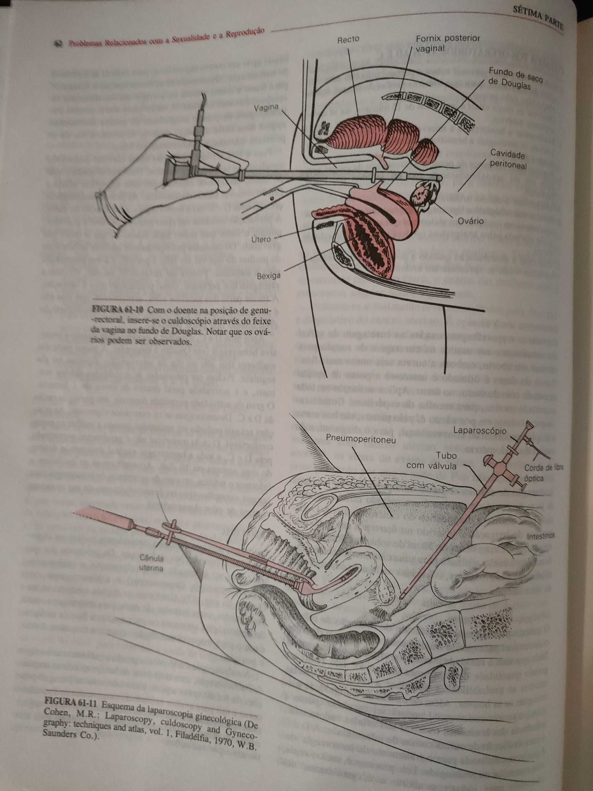 Enfermagem Médico- Cirugia