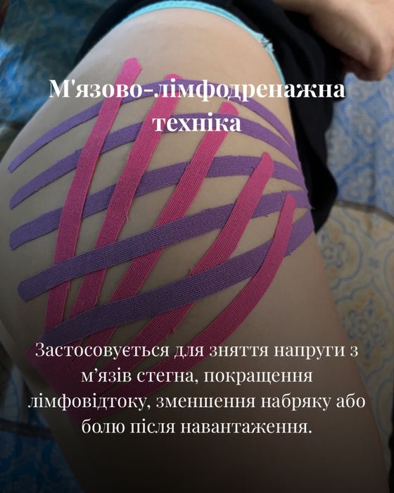 Масаж  Запоріжжя