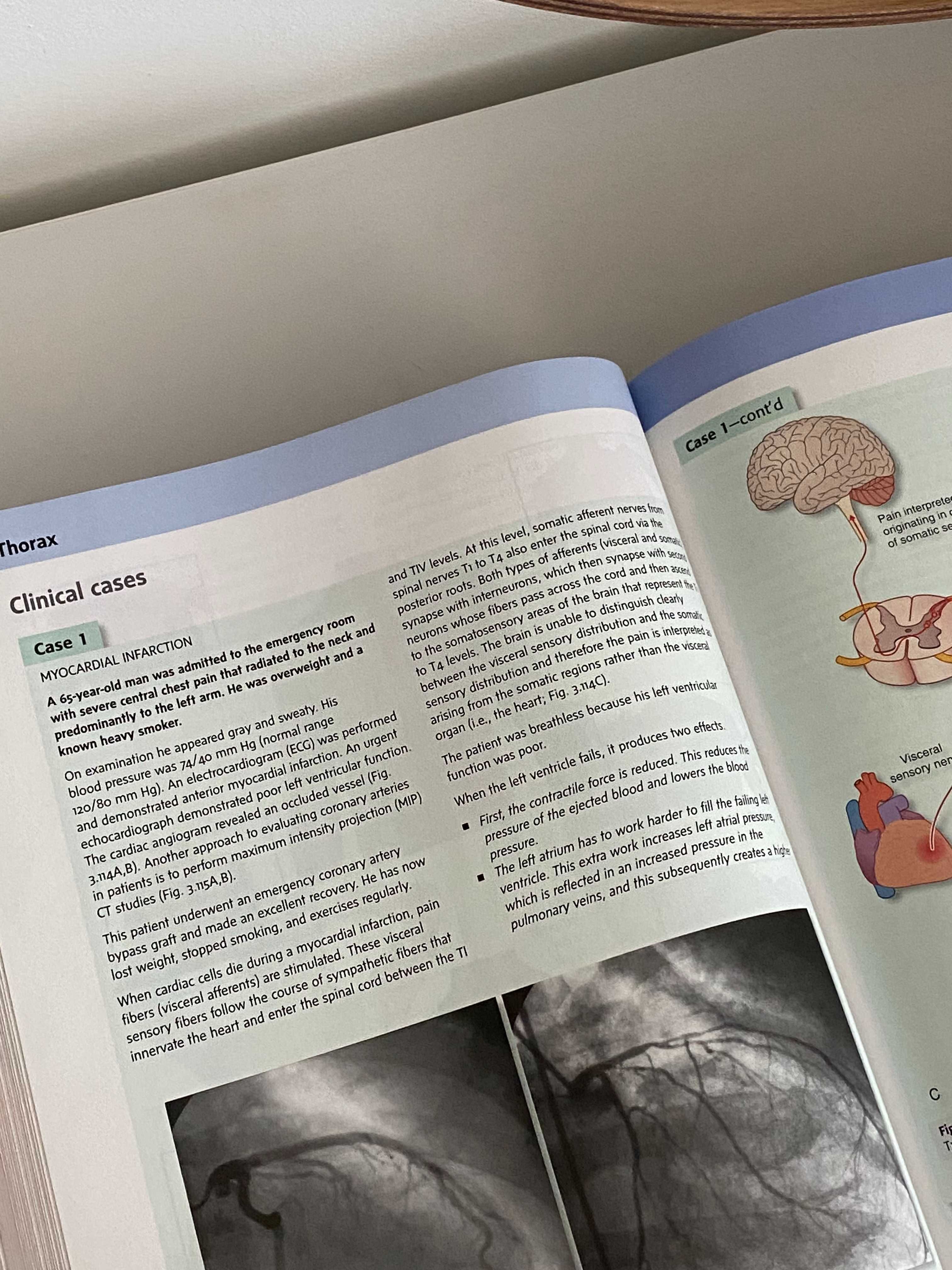 Gray's Anatomy for Students, 4th edition + digital version