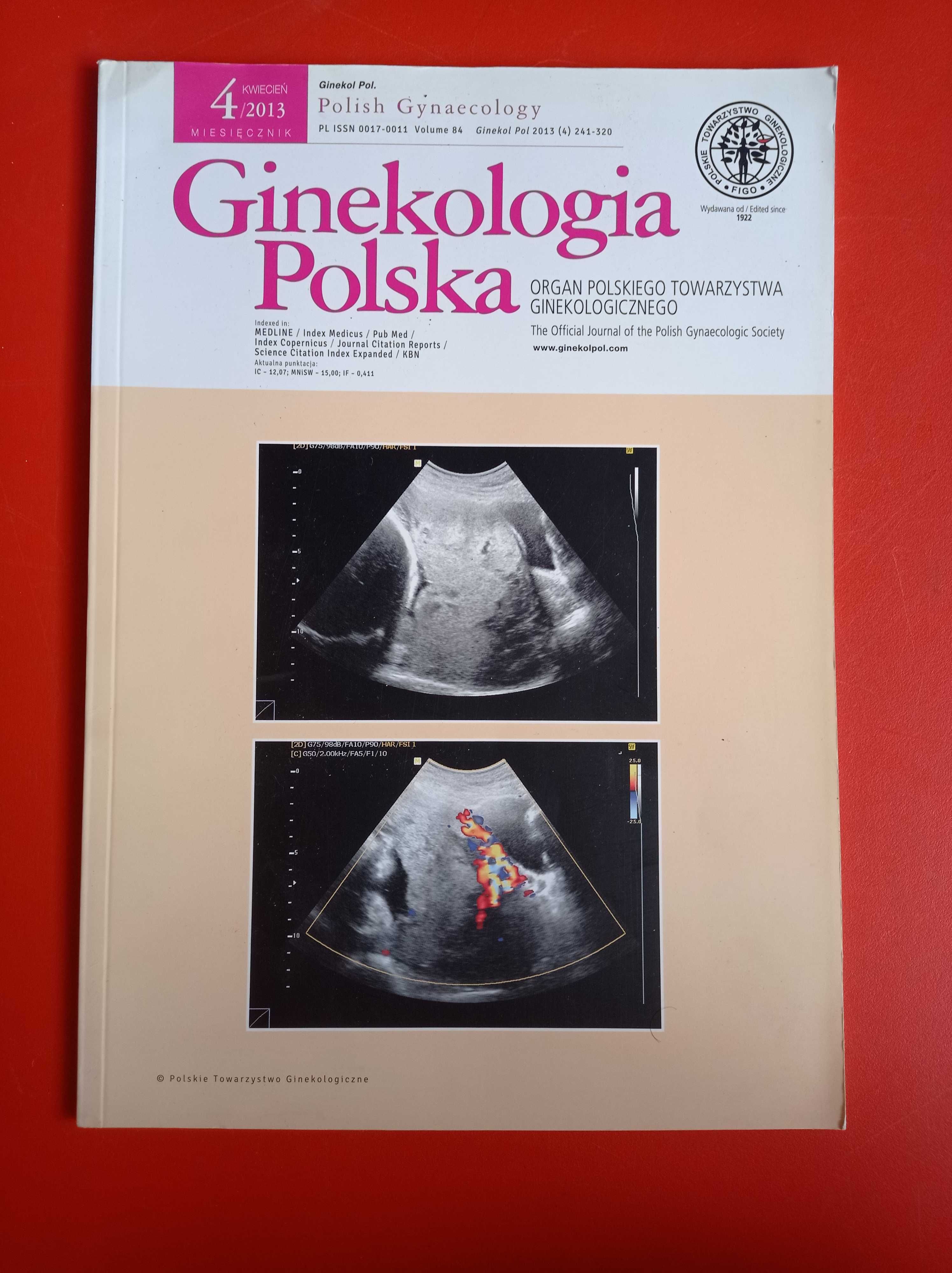 Ginekologia Polska, nr 4/2013, kwiecień 2013