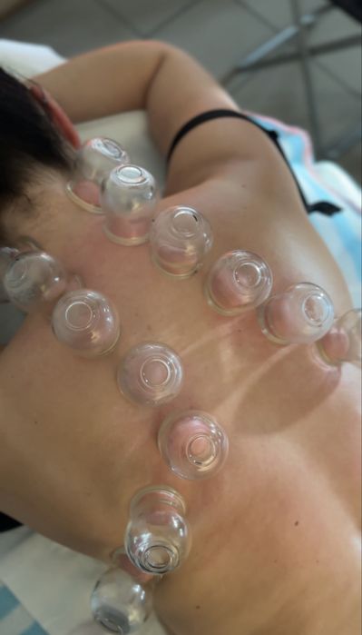 Profesjonalne masaże/ Stawianie baniek/ Masaż bańką