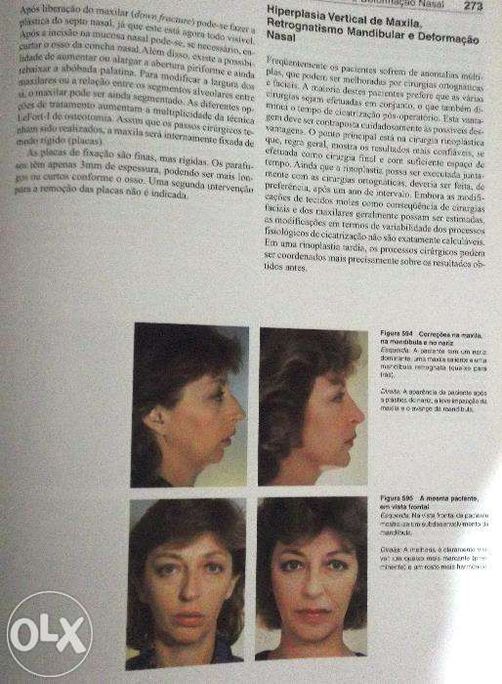 Odontologia Estetica-Atlas colorido