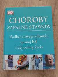 Choroby zapalne stawów