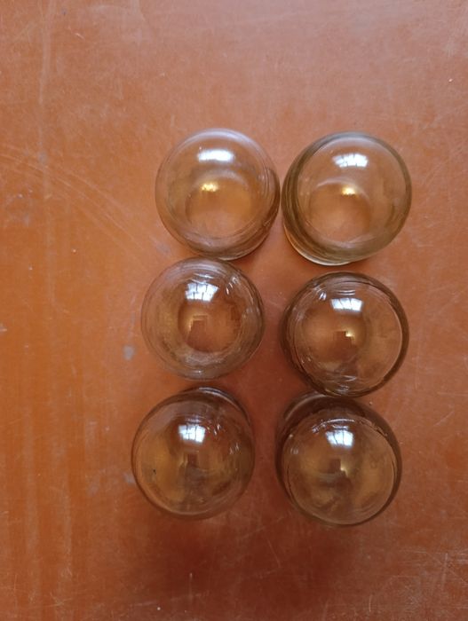 Медичні масажні банки