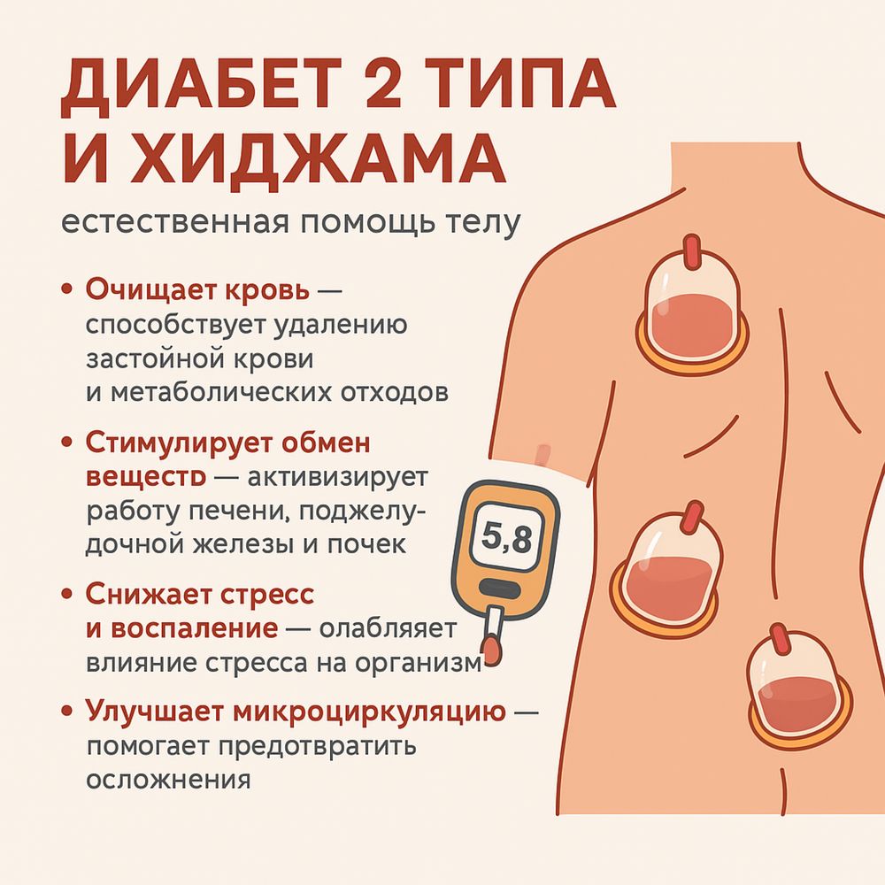 ХІДЖАМА,вакумні банки, м.Осокорки , МЦ*IMPULSE */ Срібнокільська 2б