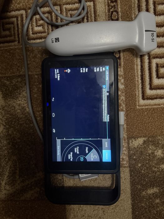 УЗД   SONOSITE iViz Portable  Ultrasound.